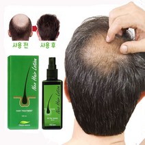 1+1 최적의 포뮬라 탈모에 효과적 탈모치료 탈모 병원 두피케어 탈모트리트먼트, 120ml