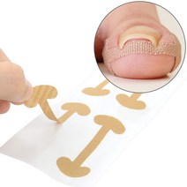 풋케어 내성발톱 교정 테이프, 1장