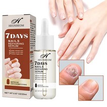 손톱 리페어 에센스 발톱무좀약 손톱 영양제, 4개, 20ml
