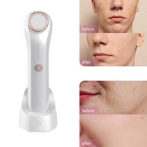 리프팅 피부 마사지기 관리기 플라즈마 페이셜 마사지 오존 장비 흉터 제거 기계 주름 방지 스킨 케어 뷰티 디바이스, 03=RoseGold