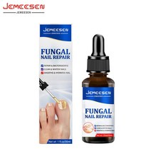 무좀 내성발톱 발톱무좀 JEMEESEN 네일 곰팡이 치료 발 관리 에센스 손톱 제거 세럼 젤 감염 방지 진균증, 01 1PCS Nail Oil