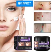 흉터제거연고 수술흉터제거 연고 화상상처 재생크림 여드름흉터 치료, 3개, 50ml