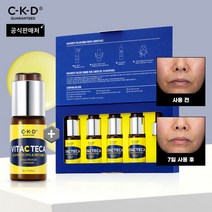 [CKD] 종근당건강 씨케이디 비타씨데카 7일잡티 앰플세트 (5개), 상세 설명 참조