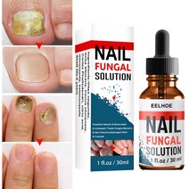 2x30ml 발톱무좀치료 발톱무좀연고 발무좀연고 리페어 에센스 손톱강화, 2병