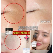 즉각 보르톡스 필러크림 or 앰플/눈가주름 입가주름 이마주름, 2%크림1+앰플1