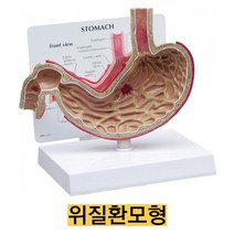 미국산/위질환모형 위궤양모형 G200/위 단면 위치별 명칭 카드 포함