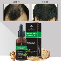 남성 여성 두피 에센스 발모제 강인하고 부드러운 풍성한 모발, 2개, 30ml