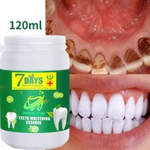 이빨 치아 치아 미백 파우더 120ml 플라크 얼룩 제거 치약 신선한 호흡 구강 위생 치아 관리 치석 제거, 02 60ml