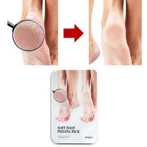 발각화증 발비닐 5회용 각질용해제 발뒤꿈치 무좀 발건조증 발꿈치 패치 발바닥 각화증
