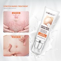 AUQUEST-임산부용 스트레치 마크 리무브 크림 퍼밍 뷰티 건강 스킨 케어 45g
