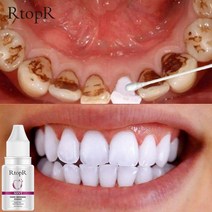 우주인무드등 감성조명 RtopR 치아 미백 에센스 플라크 얼룩 제거 구강 위생 표백 제품 클렌징 신선한 호흡 치과 치료 도구