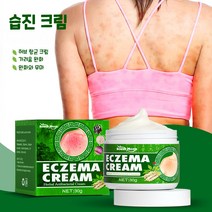 South Moon 피부건선 건선 피부 발진 피부가려움증 피부 두드러기 30g