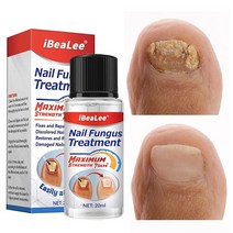 손발톱 치료제 진균 리페어에센스 발톱 케어제 발톱연화, 20ml*1개, 1개