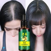 효과적인 생강 모발 성장 연고 모발 관리 건강한 탈모 방지 에센스 오일 손상된 모발 영양 크림, [01] 5ml, 5ml