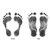 근저 근 족 족적 족저 근막염 족막염 금막염 평발운동화 군입대준비물