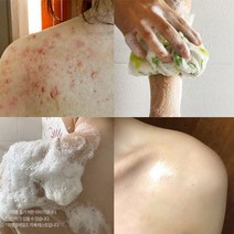 라벨영화장품 [라벨영] 쇼킹고약한바디비누, 쇼킹고약한바디비누 3개