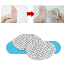 발독소 발냉증 목초액 무좀 효능 발바닥 열감 종아리근육경련 몸붓기빼는법 손발차가움