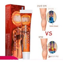 SUREYOULiKE 고온정맥류 치료 크림 바스큘리스 플레비티스 스파이더 레그 연고 허브 석고 혈관염 제거 패치 바디 크림 바디 셀프 태너즈, 없음