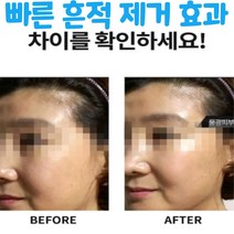 제이블릭 기미 반점 검버섯 주근깨 흔적 피부착색 제거 지우개 미스트 앰플 에센스 연고 크림 점제거 제거제 남성 여성 30대 40대 50대 60대 집중케어 크림, 효과빠른 미백 흔적 제거