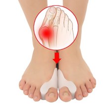 굽은등 굽은어깨 라운드숄더 교정기 교정발가락 분리기 깔창 링 외반증 교정 패드 풋 케어 정형 외과 발, 03 1Pair White