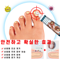 문제성 손 발톱 무좀 치료 두꺼워짐 곰팡이 리페어 연고, 5개, 30ml