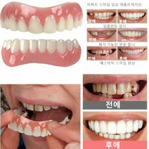 임시치아 틀니 세트 스마일 치아 화이트닝 상부 하부 탈착식 치아보호용 마우스피스 쉬운 착용, 윗니+아랫니