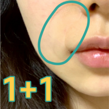 1+1 팔자주름 미간주름 눈가주름 패치, 둥근 타입(총 54개입)
