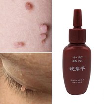 옥수수 수확기 탈곡기 효과적인 스킨 태그 리무버 젤 제거 두더지 페릴로마스, 한개옵션0