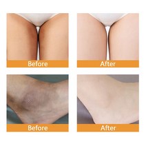 은밀한 부품을 위한 미백 크림 바디 무릎 팔꿈치 목 칙칙한 색소 제거 피부톤 밝고 균일한 스킨 케어 제품, 02 3pcs