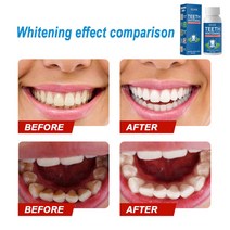 치아 미백 파우더 얼룩제거 화이트닝 30ml 청소 액체 구강 관리 제거 치석 연기 얼룩 광택 미백제