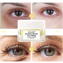 MSLAM 눈밑지방제거 눈밑꺼짐 눈밑주름 바나나 아이크림, 20ML