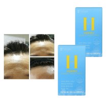 먹는히알루론산 하이루론산 히알루론산영양제, 1개