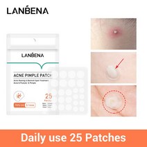 LANBENA-여드름 여드름 패치 페이스 마스크 보이지 않는 스티커 흠집 치료 리무버 마스터 도구 스킨 케어 페이셜 크림, [01] A