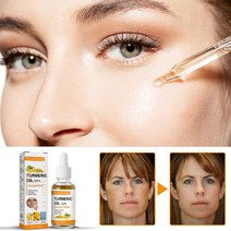 에센스 세럼 심황 페이스 화이트닝 다크 스팟 리무버 여드름 흉터 밝은 피부 에이징 오일, 10ml, 1개