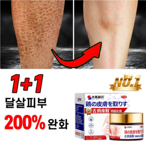 [200%완화] 1+1 일본 모공 각화증 바디로션 닭살 피부 제거 크림 뱀살 연화 보습제, 1개, 30g