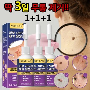 [HPV바이러스/본토출하] 문제를 해결하는 피부치료 제거제, 3개, 20ml