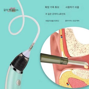 블라썸즈 귀지흡입기 조명 귓밥 LED 귀파개 귀클리너, 1개, 귀+코 흡입 장치 (독일 품질)