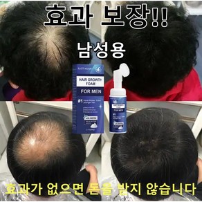 탈모 예방 두피케어 탈모남성을 위한 디자인, 2개, 60ml