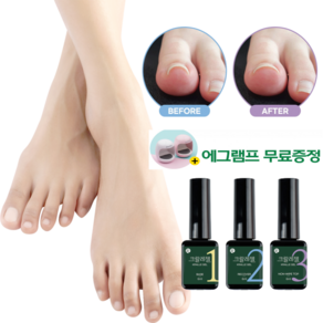 발톱연화제 파고드는 발톱 업젤 닥터크랄레젤 3종세트, 크랄레젤 미니 6ml 3종세트 + 우드파일 + 에그램프, 1개