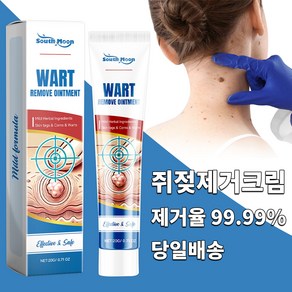 [병원직거래] 각종 사마귀/편평사마귀/속립증/안면사마귀 빠르고 효과적으로 제거 SM013