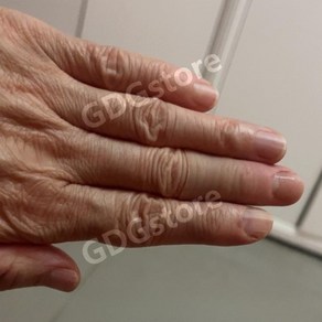 손가락 의수 가짜 실리콘 인공 맞춤제작 절단 발가락 선물, 1개, 새끼지