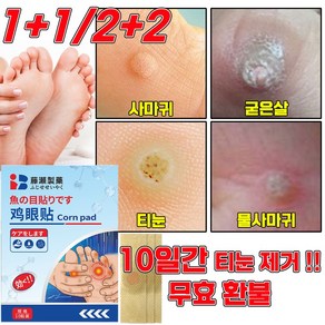 [당일 발출] 티눈제거 발바닥 통증 완화 티눈밴드 보호테이프 손가락 발가락 티눈뿌리 제거 패치