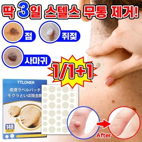 [효과보증!!] 피부 제거 패치 얼굴 바디 손 발바닥 피부 치료 스텔스 라벨