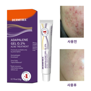 DERMFREE 여드름 연고 좁쌀여드름 연고 A-15