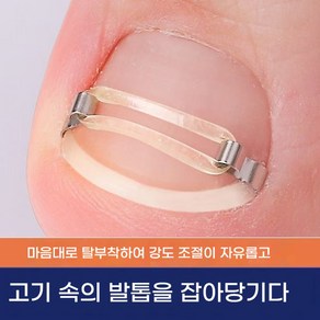 내성발톱 내성발톱교정 라텍스 내성발톱교정기 내향성발톱 자가치료 양측