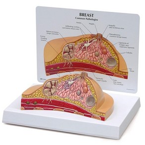 인체모형 해부모형 여성 유방 구조 해부학 질병 암 병리학 적 유방 해부학 교육 및 훈련, 없음