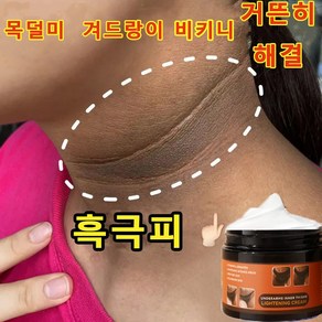 MEJIOSS [대용량] 멜라토닝크림 색소침착 연고 색소침착연고 겨드랑이 색소침착 색소침착연고 멜라닌 억제, 4개, 140g