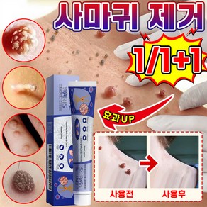 [국내배송] 1+1/2+2 미국 피부 치료 편평 연고 신속하고 효과적인 기미 비립종 제거 스킨 제거 크림 최저가격 포장증정