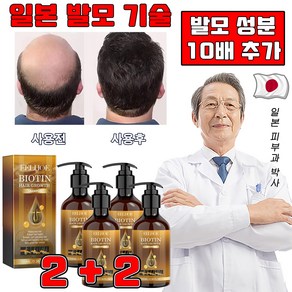 일본 개발 1/1+1 바이오틴 탈모 샴푸 탈모 완화 비오틴 손상모발개선 샴푸 투피활력 남녀공용 선물 랜덤 증정, 4개, 100ml