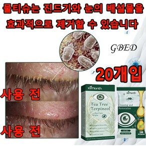 GBED 안구건조증 눈기름샘청소 진드기퇴치 눈꺼풀세정제 단백질제거제 노폐물제거눈물 눈기름샘청소 아이케어, 1세트, 수량